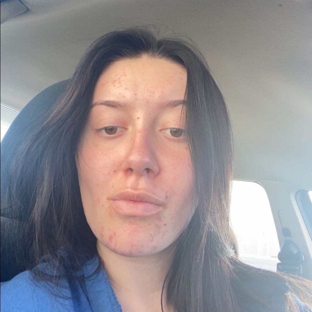 Meet your Posher, Linnea